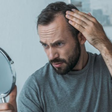 serenoa prostata e calvizie